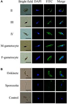 Plasmodium TatD-Like DNase Antibodies Blocked Parasite Development in the Mosquito Gut